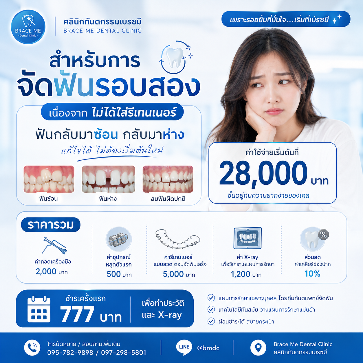 จัดฟันรอบสอง