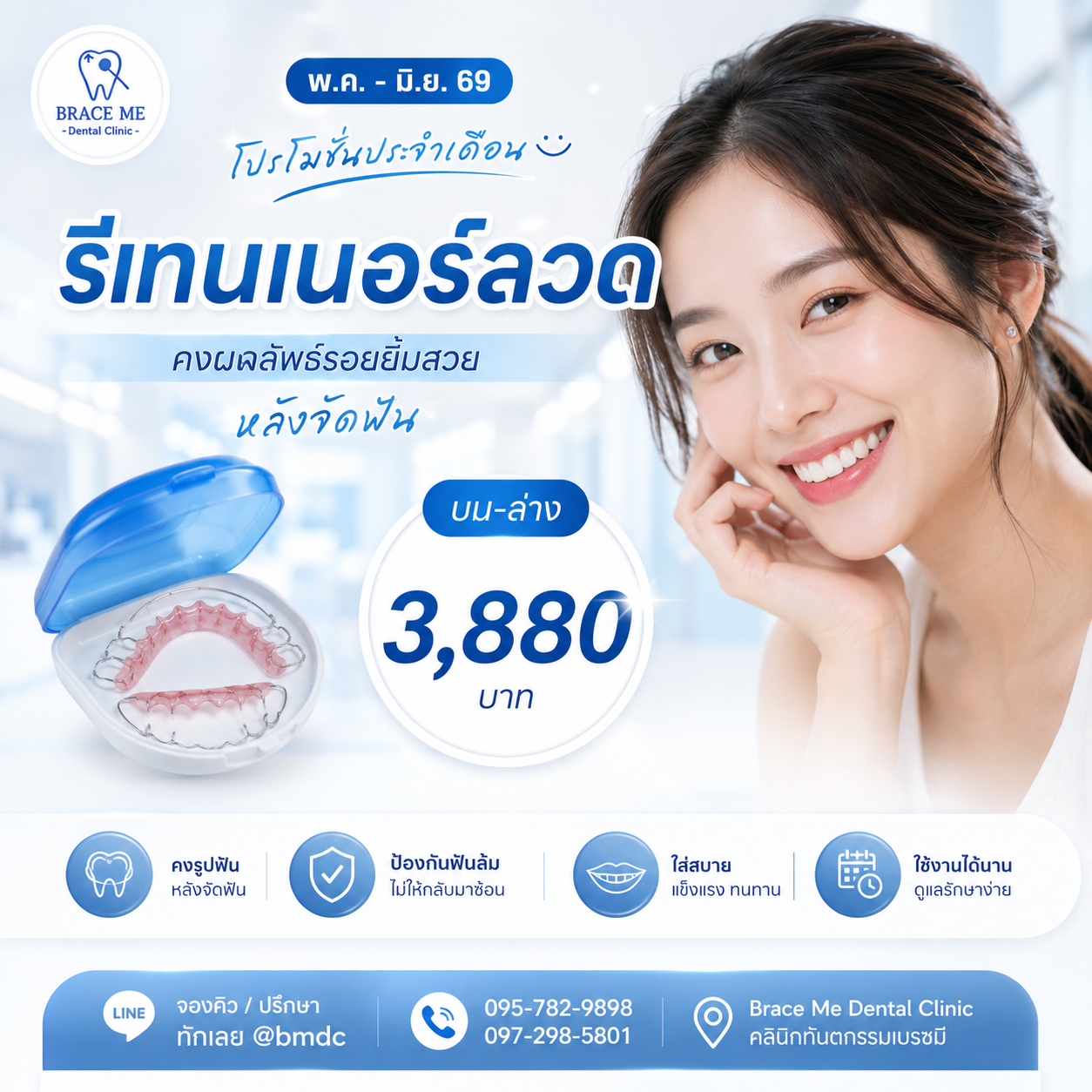 รีเทนเนอร์ลวด